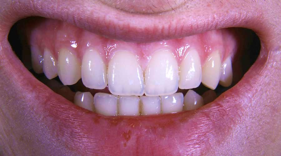 Thousands More Dentists Set to Boost NHS Appointments